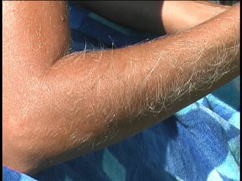 MILF Lori Anderson shows close up of her extremely long arm hair on the beach - #12