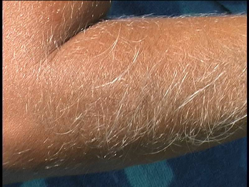 MILF Lori Anderson shows close up of her extremely long arm hair on the beach - #3