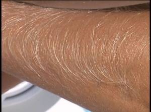 MILF Lori Anderson shows close up of her extremely long arm hair on the beach on clubgf.com