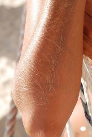Amateur model Lori Anderson shows her hairy arms in a bikini and sunglasses on clubgf.com